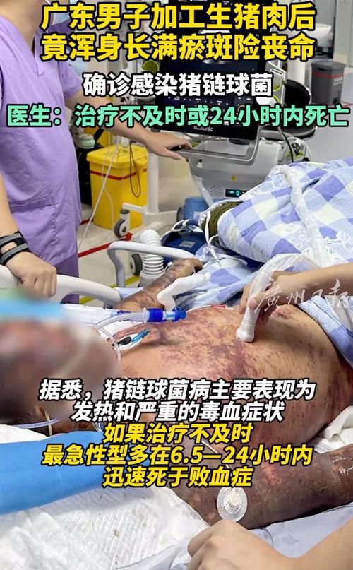 新澳天天彩2025芳草地和吃剩菜后被送医抢救与吃剩菜住进icu