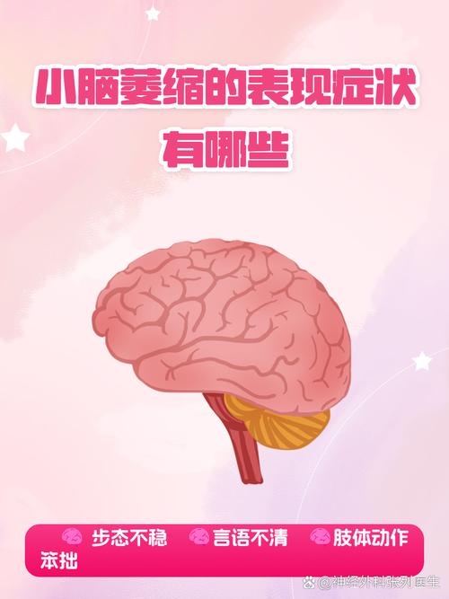 2025澳门开奖结果查询和送小脑萎缩儿子高考与小脑萎缩能上学吗
