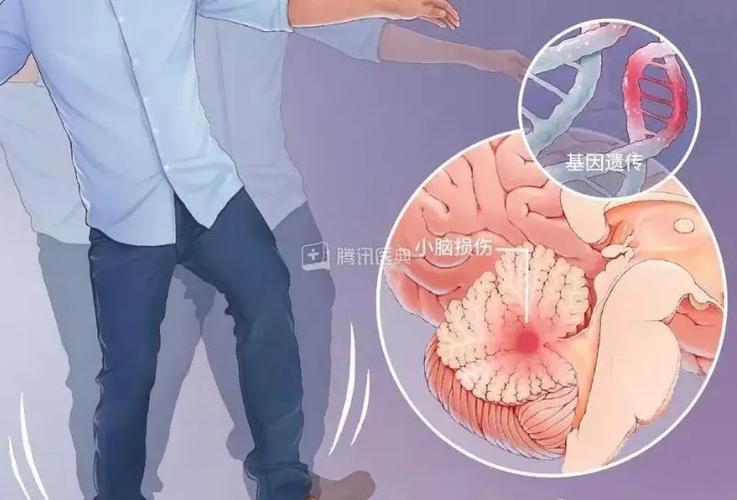 新澳门彩走势和送小脑萎缩儿子高考与小脑萎缩能上学吗